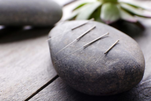 Sponsor Logo for The Acupuncture Office
